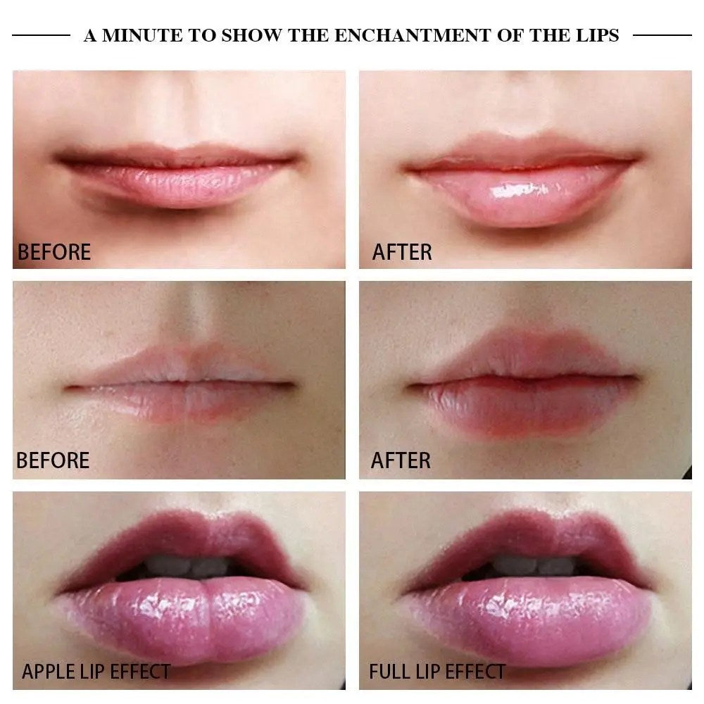 Premium Device Manual for Voluminizing Lips